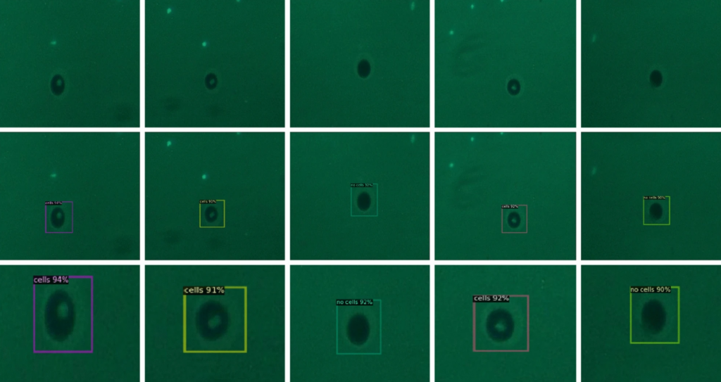 Tricorder Tech: Automated Detection Of Isolated Single Cells Using Microscope Images And AI