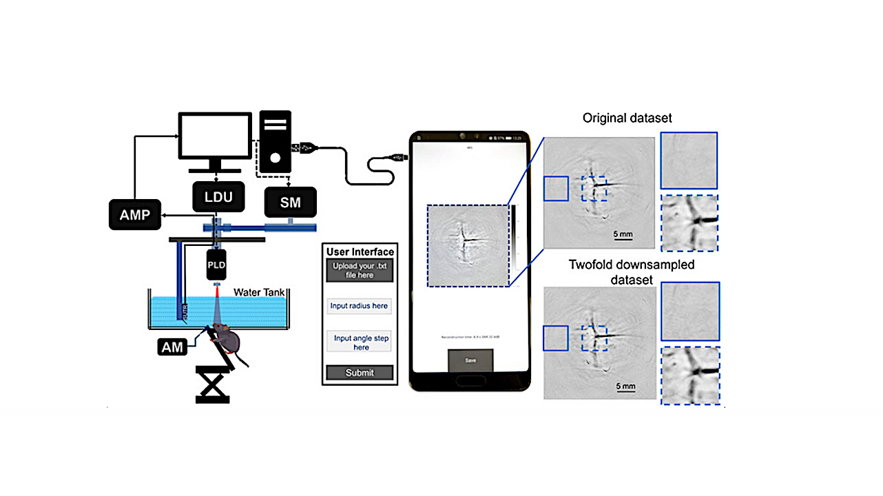 Tricorder Tech: Android-based Application For Photoacoustic Tomography Image Reconstruction