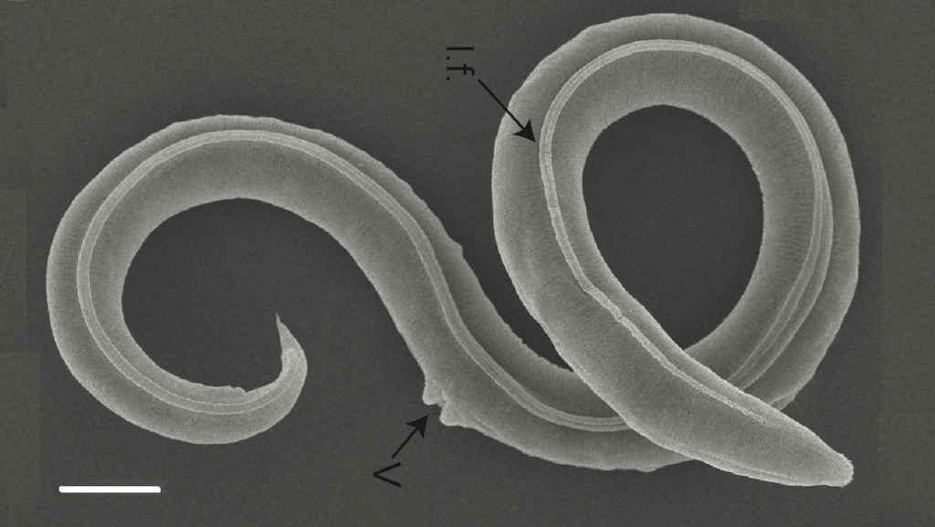 Genome Analysis Of 46,000-year-old Roundworm From Siberian Permafrost Reveals Novel Species