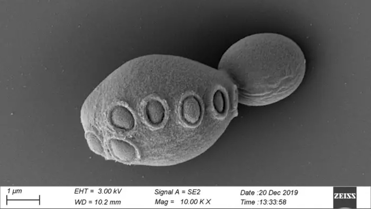 One Step Closer To Re-writing The First Synthetic Yeast Genome And Unravelling The Fundamental Building Blocks Of Life