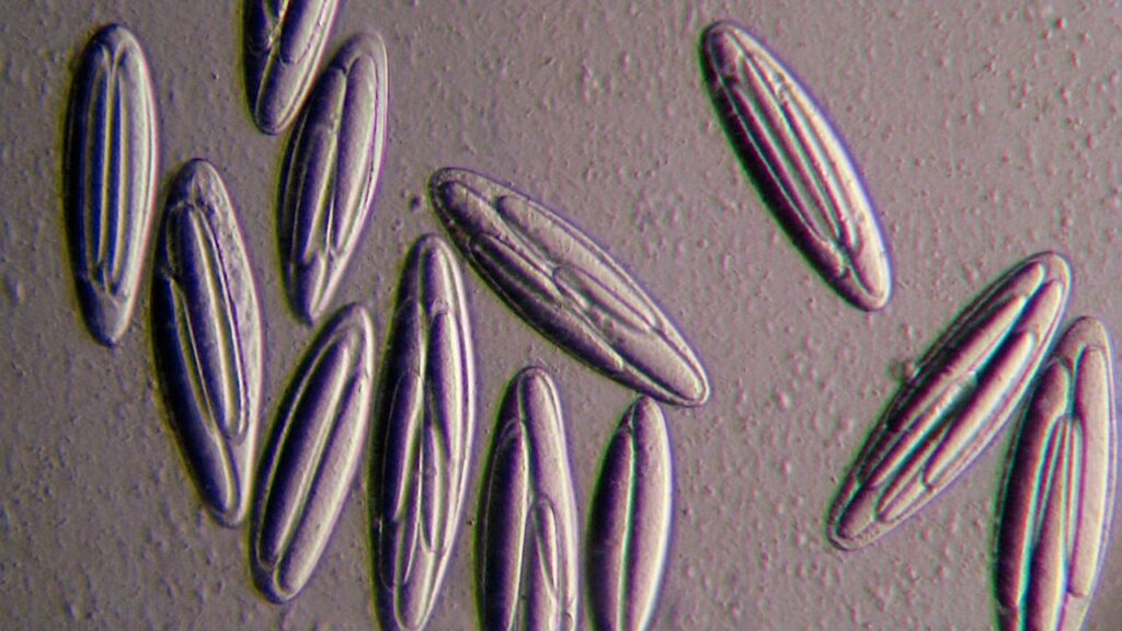 Giant Bacterium Epulopiscium viviparus Uses Unique Processes To Power Itself