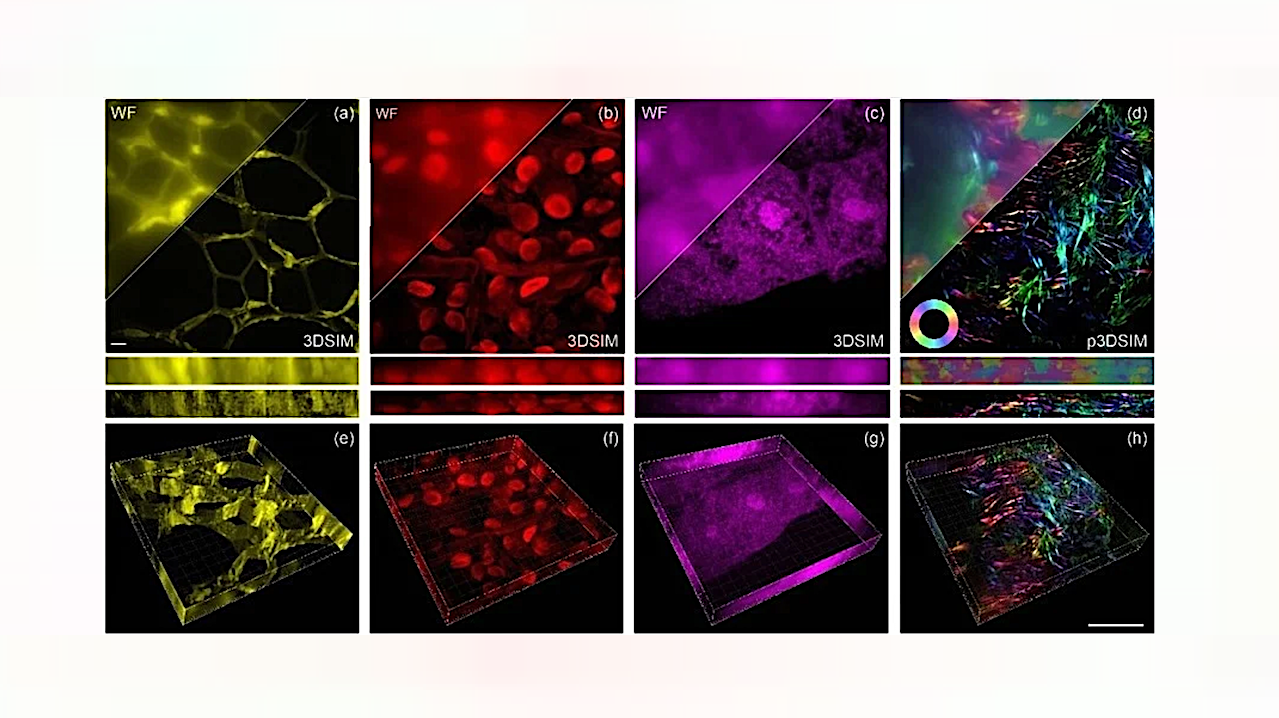 Tricorder Tech: High-speed, Auto-polarization Modulated 3D Structured Illumination Microscopy Imaging
