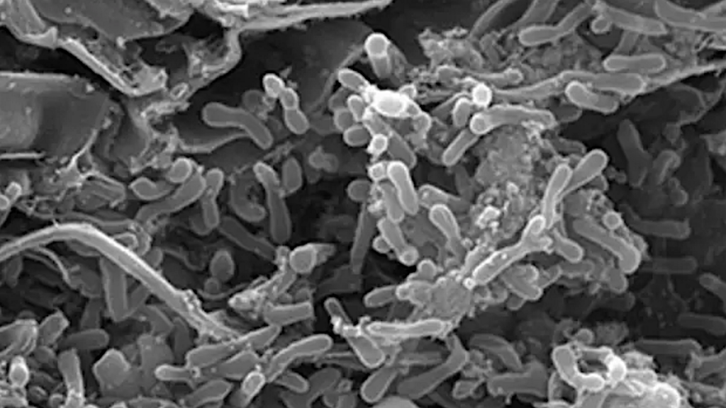 Genes Identified That Allow Bacteria To Thrive Despite Toxic Heavy Metal In Soil