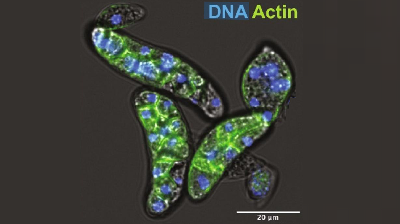 Ancient Microbes Offer Clues To How Complex Life Evolved