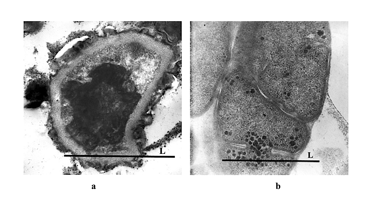 Survival Of Microorganisms During Two-year Exposure Outside The International Space Station