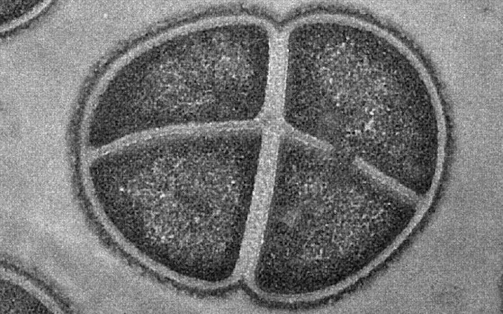 Insights Into The Synthesis, Engineering, And Functions Of Microbial Pigments In Deinococcus Bacteria