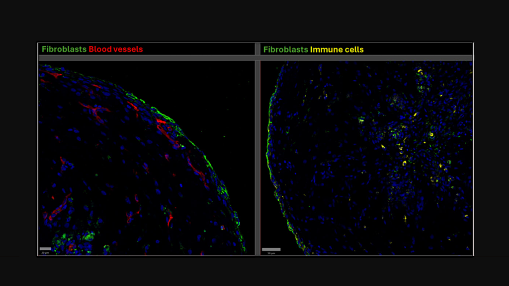 Offworld Life Science: Immunofluorescence Staining Of A Synovial Organoid