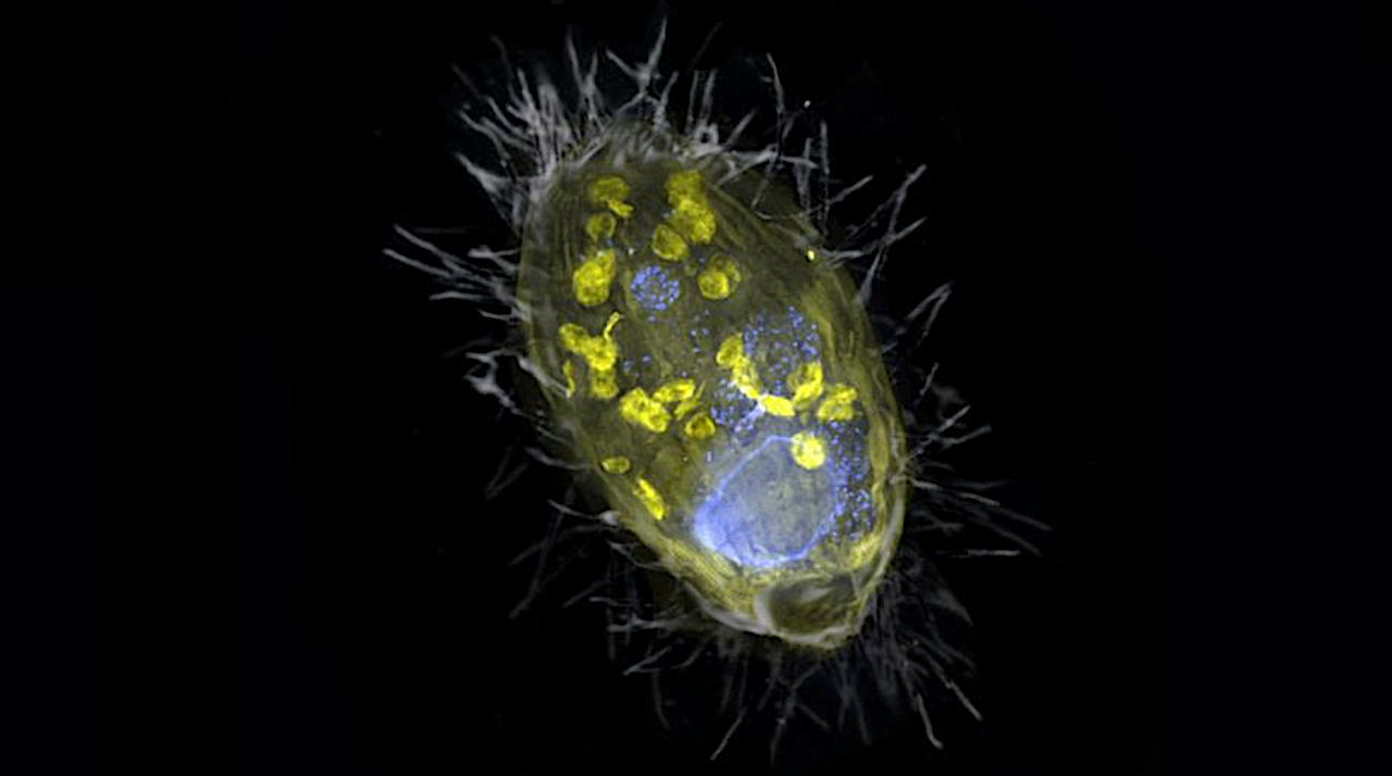 Oxygen Is Not The Limit: Diversity And Metabolic Potential Of Globally Distributed Endosymbionts