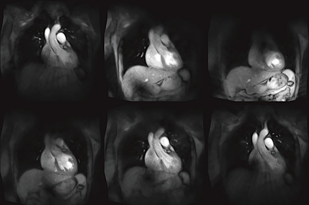 FLASHlight MRI: Real-Time Tricorder Tech Brings Star Trek Medicine Closer