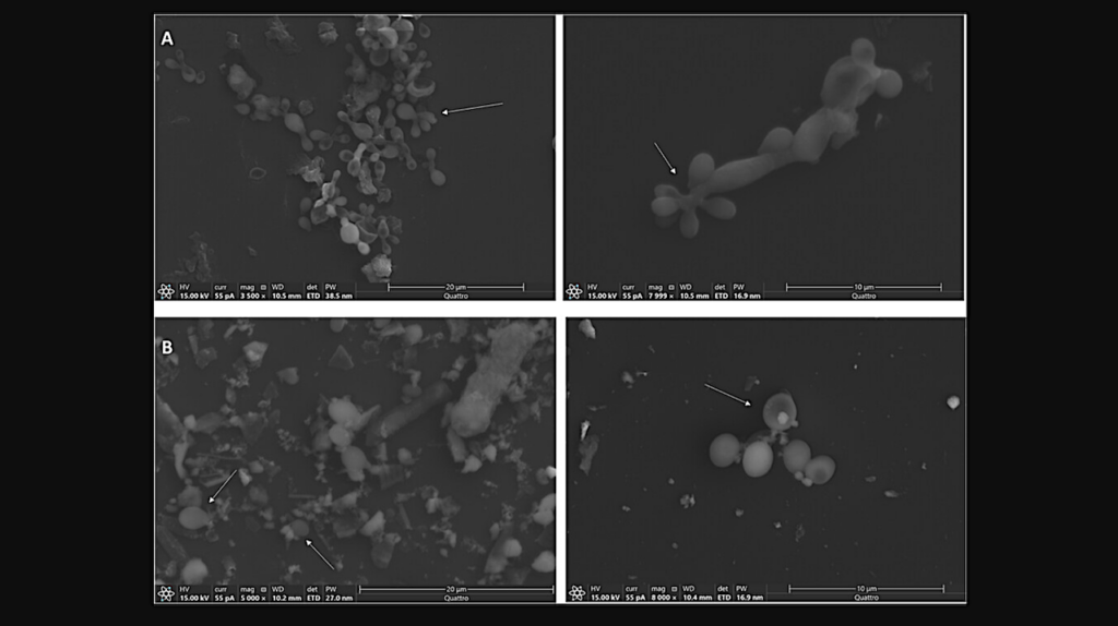 Rhinocladiella similis: A Model Eukaryotic Organism for Astrobiological Studies on Microbial Interactions with Martian Soil Analogs