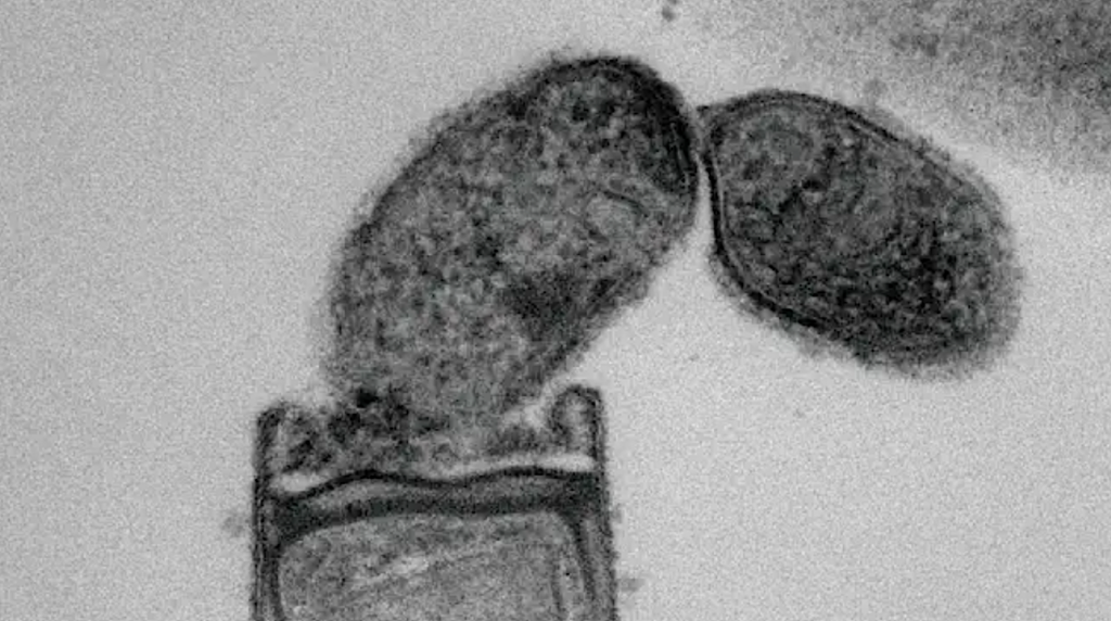 Novel Bacteria That Parasitize Archaea