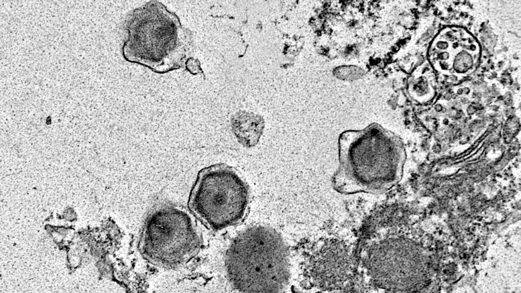 230 New Giant Viruses Discovered That Shape Earth’s Oceans