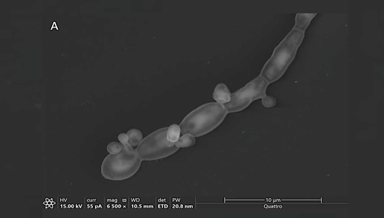 Survival Strategies Of Rhinocladiella Similis In Perchlorate-rich Mars Like Environments