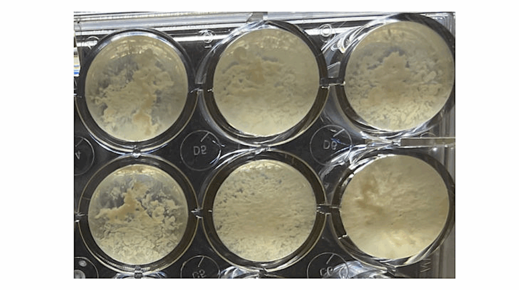 Tersicoccus phoenicis Microbes Found In A Spacecraft Clean Room Exhibits Dormancy