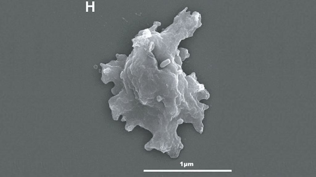 A Geothermal Amoeba Sets A New Upper Temperature Limit For Eukaryotes