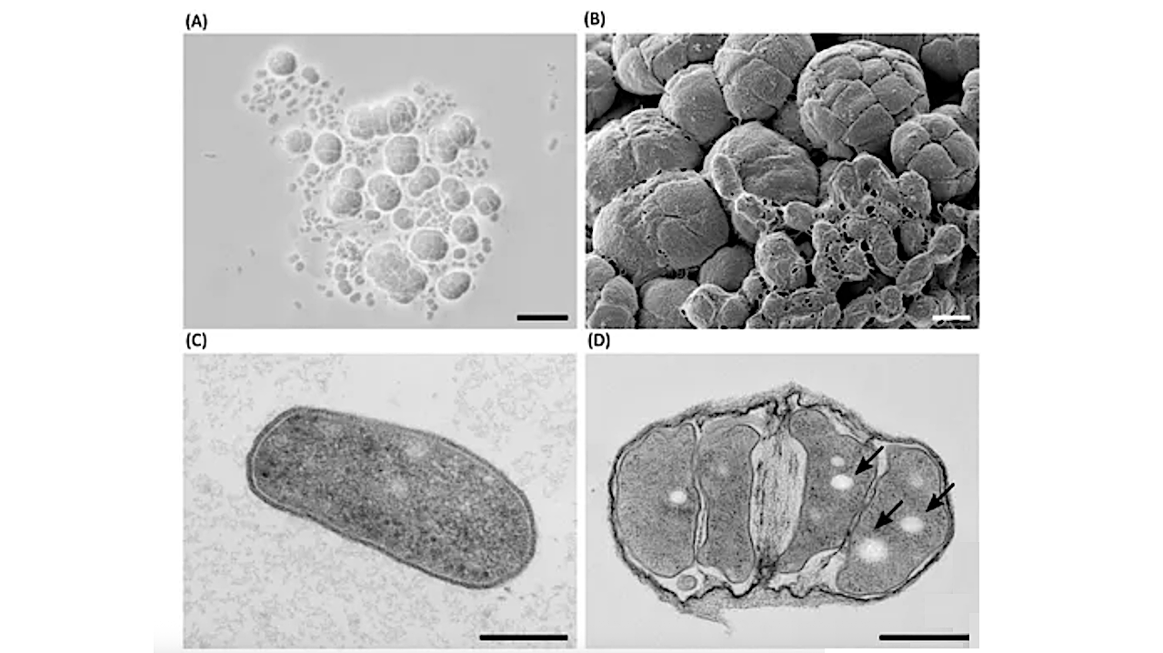 Life In The Brine Of Lunenburg, Germany: Unveiling Microorganisms Associated With Zechstein Salt Deposits