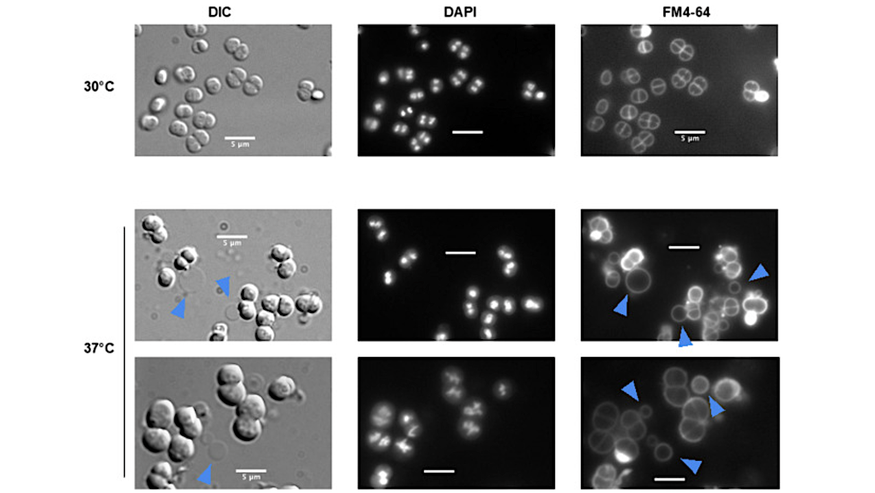 Specific Role Of Two NlpC/P60 Endopeptidases In Cell Division And Membrane Vesicle Formation In Deinococcus radiodurans