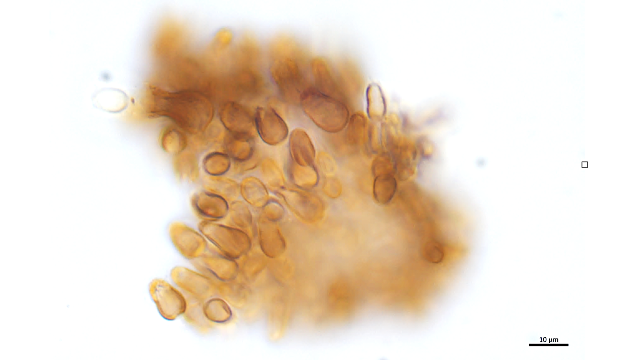 Novel Raman Signature Evidences An Unknown Cyanobacterial Pigment